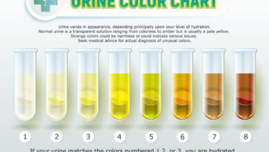 cloudy urine